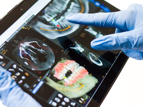 先生がレントゲンを見ている画像